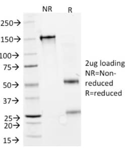 IFN-alpha Mouse anti-Human, Clone: N27, Novus Biologicals:Antibodies:Primary